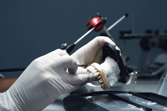  Advanced Prosthodontic Services